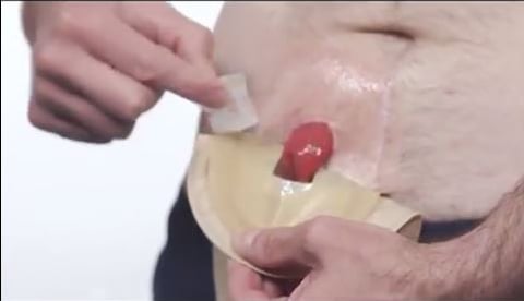 a person holding a pill