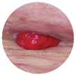 soft or flaccid abdomen